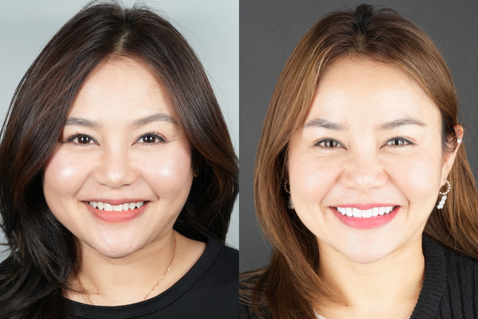 Smile transformation